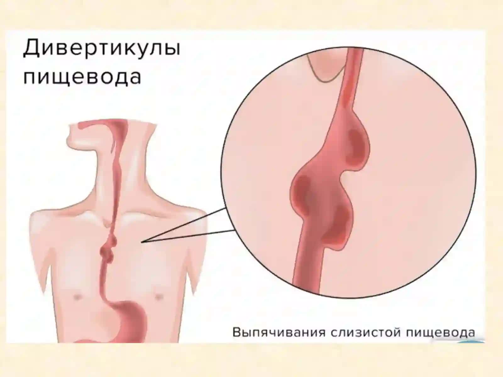 ПАТОЛОГИК АНАТОМИЯ 6- маъруза “Бош, бўйин,ошқозон – ичак касалликлари” Тошкент - 2021 3