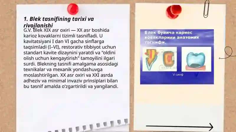 Karioz kovaklarining Blek bo'yicha tasnifi 3