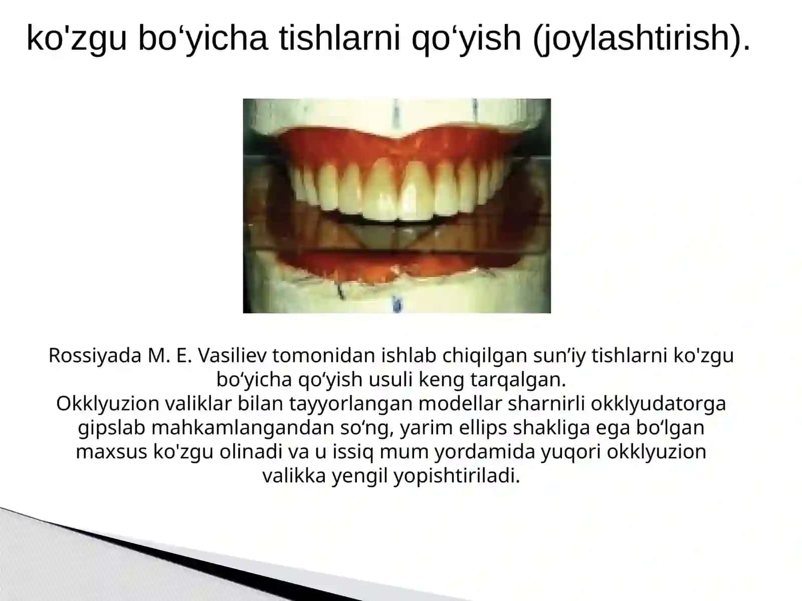 Sun’iy tishlarni terish usullari. 3