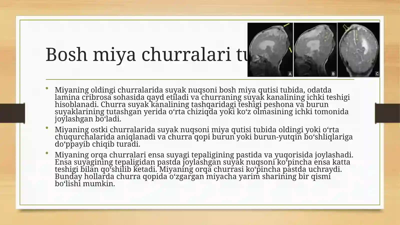 Boshmiyavaorqamiyatug‘marivojlanishnuqsonlari 3