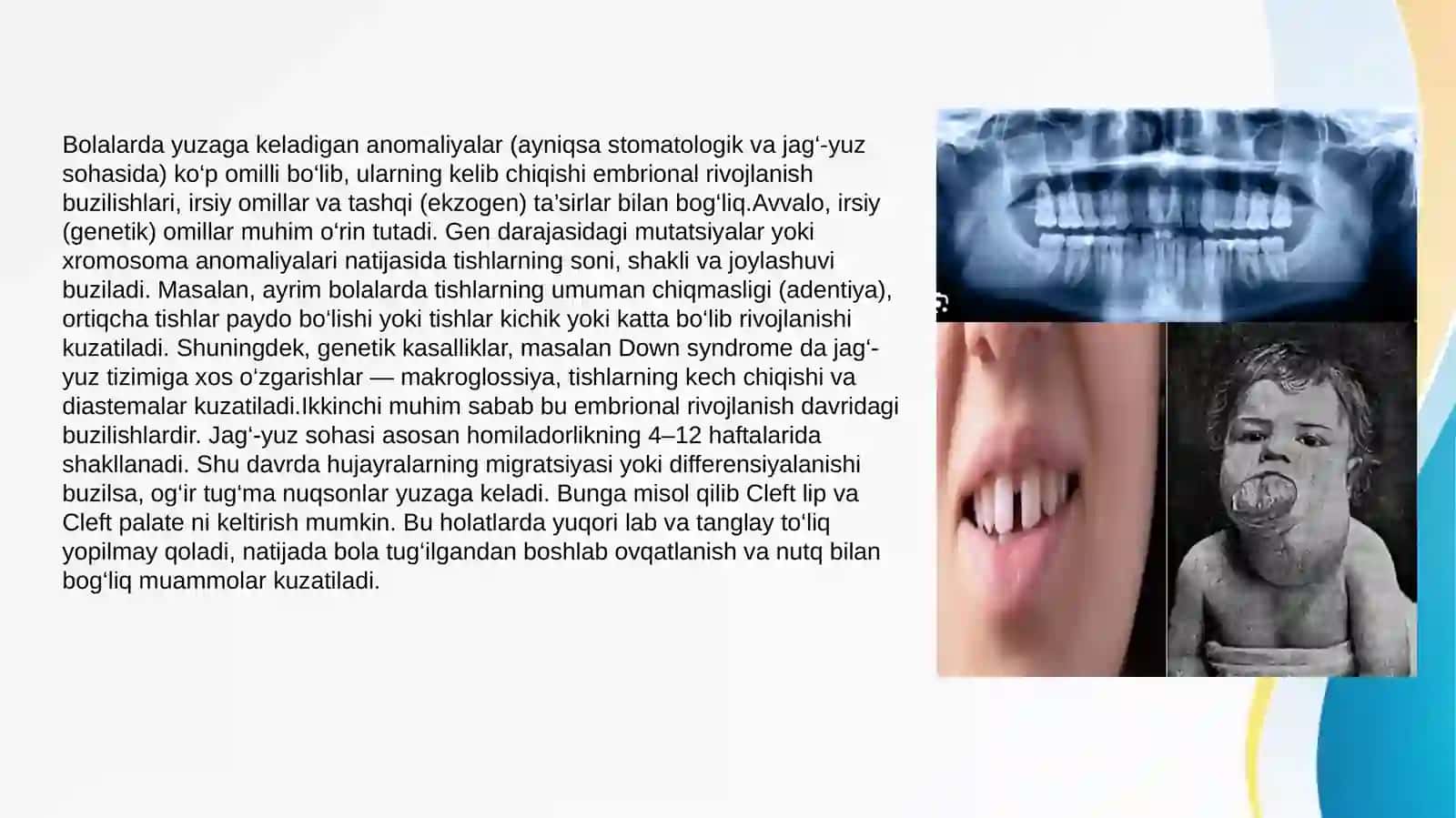 Bolalar stomotologiyasidsa anomaliya va deformatsiyalar rivojlanishida zararli odatlar 3