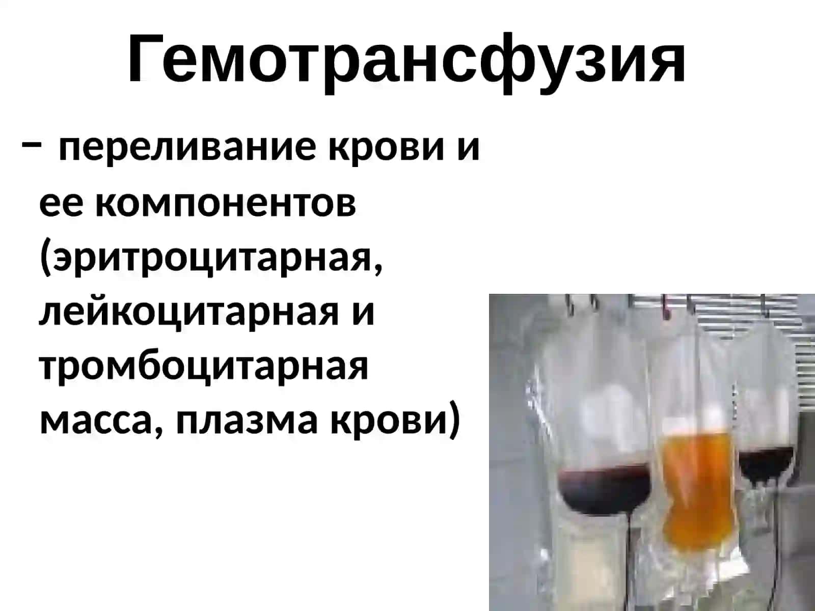 ПЕРЕЛИВАНИЕ КРОВИ. СОВРЕМЕННЫЕ АСПЕКТЫ ТРАНСФУЗИОЛОГИИ 3