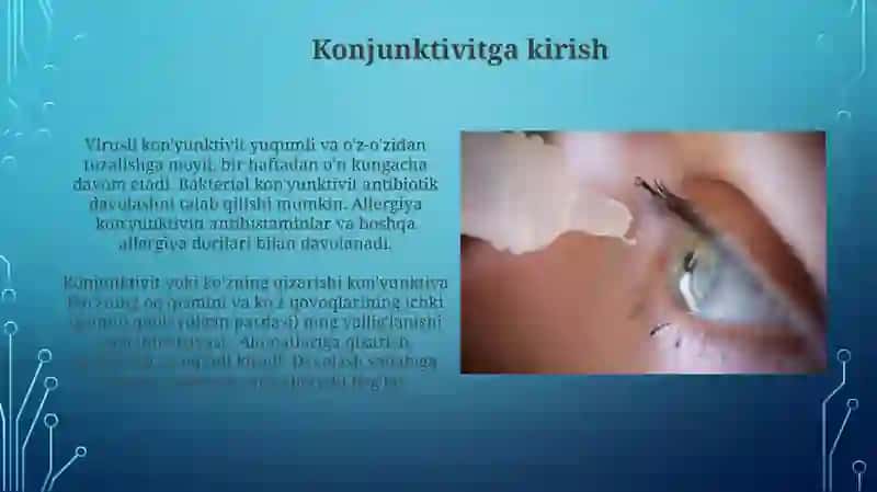 Kon'yunktivit kasalliklari 3