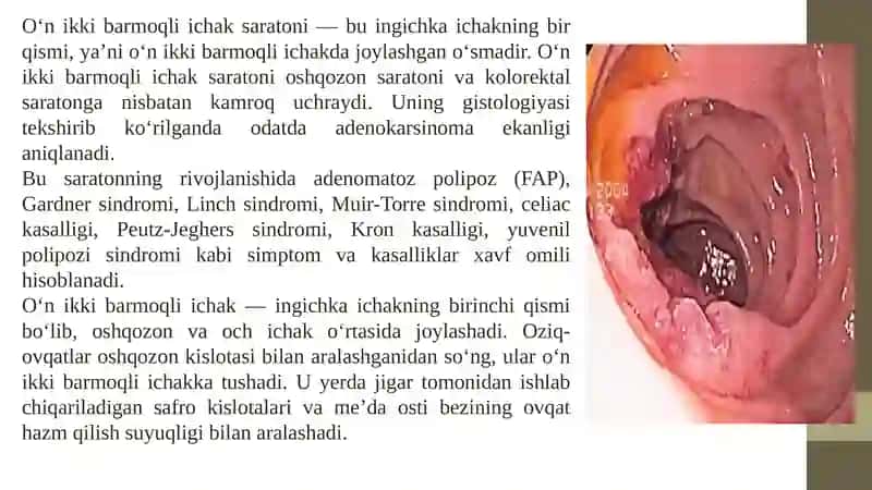O'n ikki barmoq ichak anatomiyasi va fiziologiyasi 3