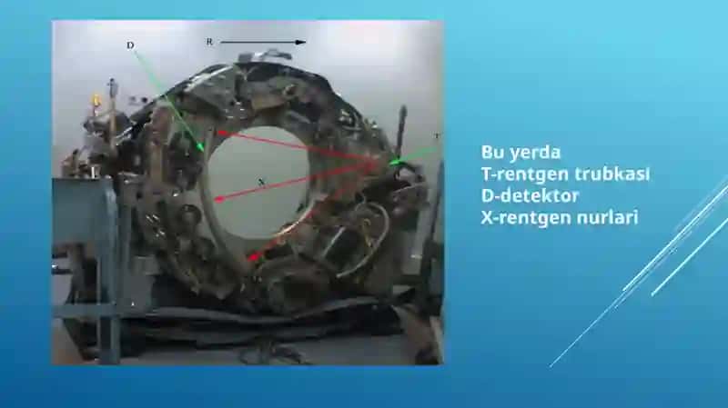 Multi spiral komputer tomografiya 3