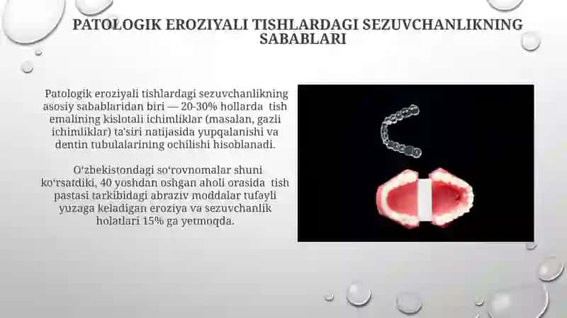 Patologik Eroziyaga Uchragan Tishlardagi Sezuvchanlikni Davolash Usullari 3