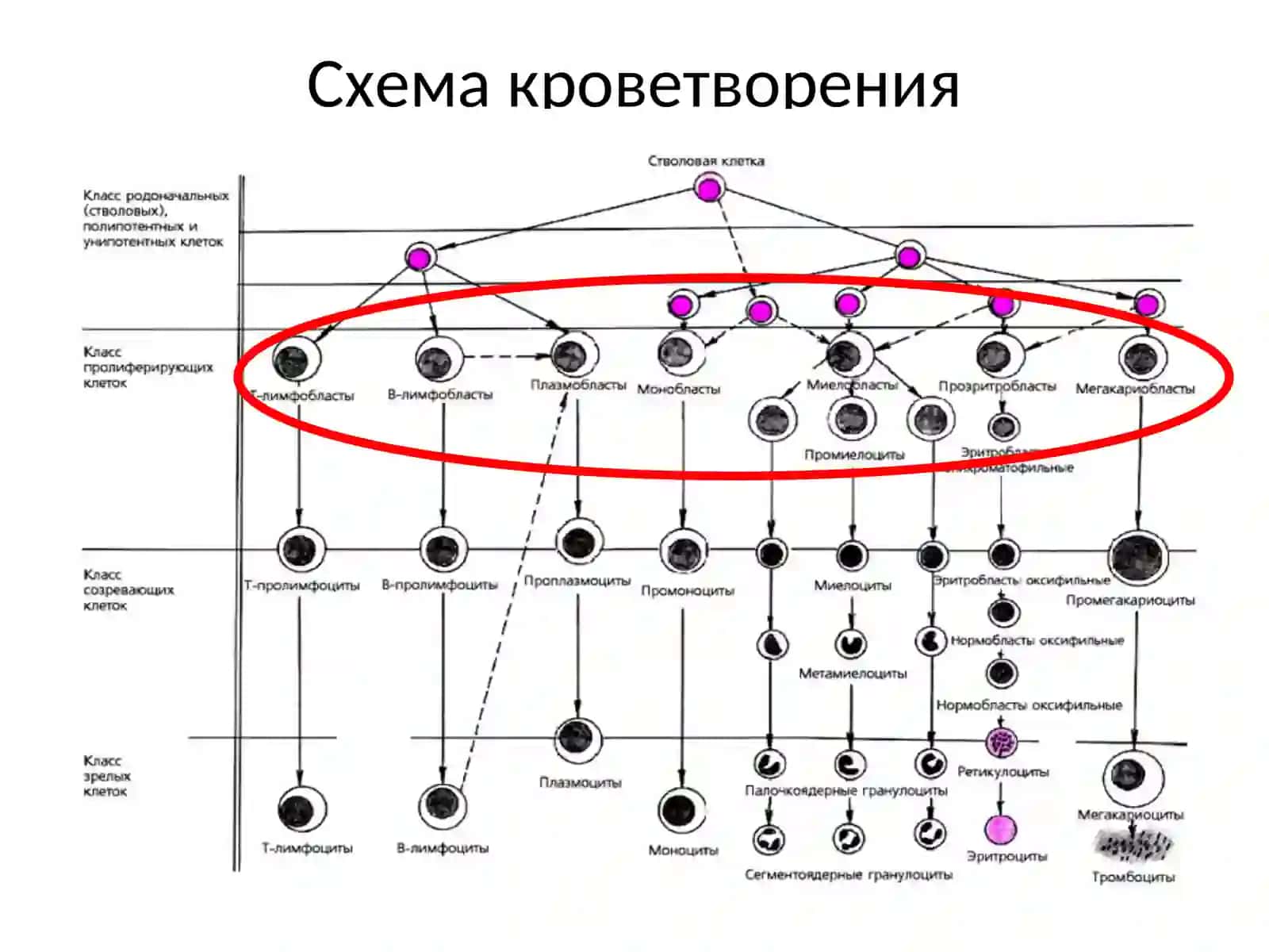 Лейкозы 3