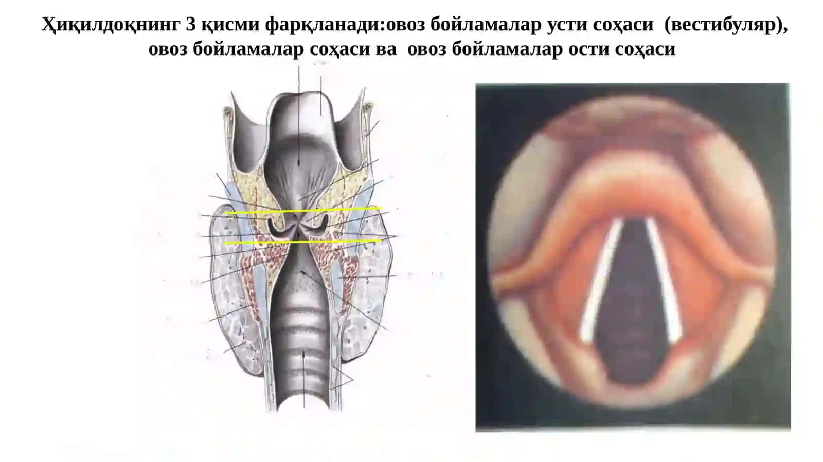 Ҳиқилдоқ раки-С32 3