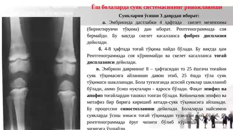 Суякларнинг тараққий этиши, тузилиши ва рентгеноанатомияси 3