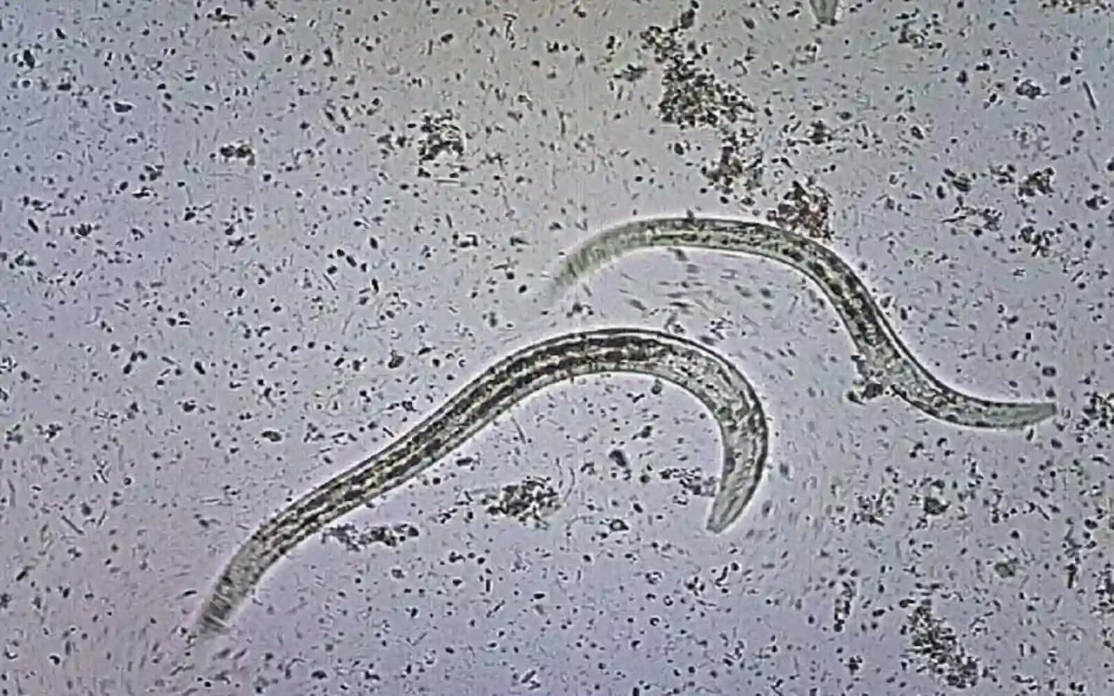 7-sinf Zoologiya 'Parazit chuvalchanglarning xilma-xilligi' ko'rgazma 3