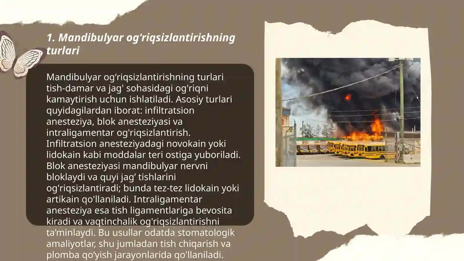 Mandibulyar Ogʻriqsizlantirishni Ogʻiz Tashqi Usuli 3
