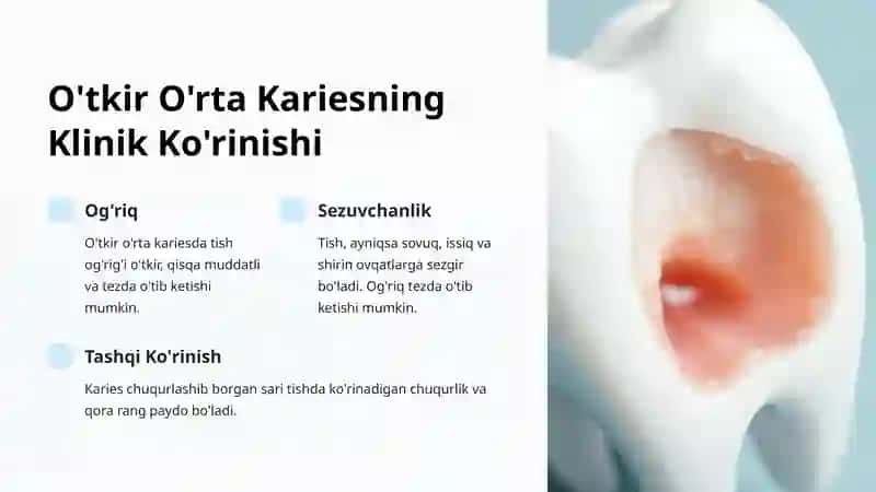 O'rta Karies: O'tkir va Surunkali Shakllari 3