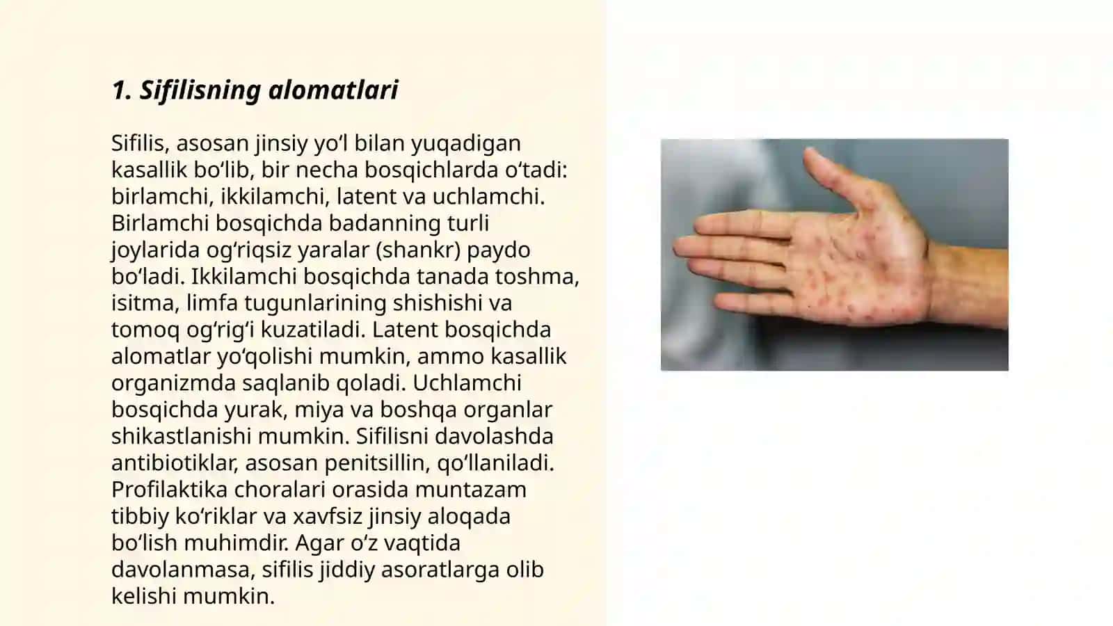 Teri-tanosil kasalliklari.Sifilis.Gonoreya.Chlamydia 3