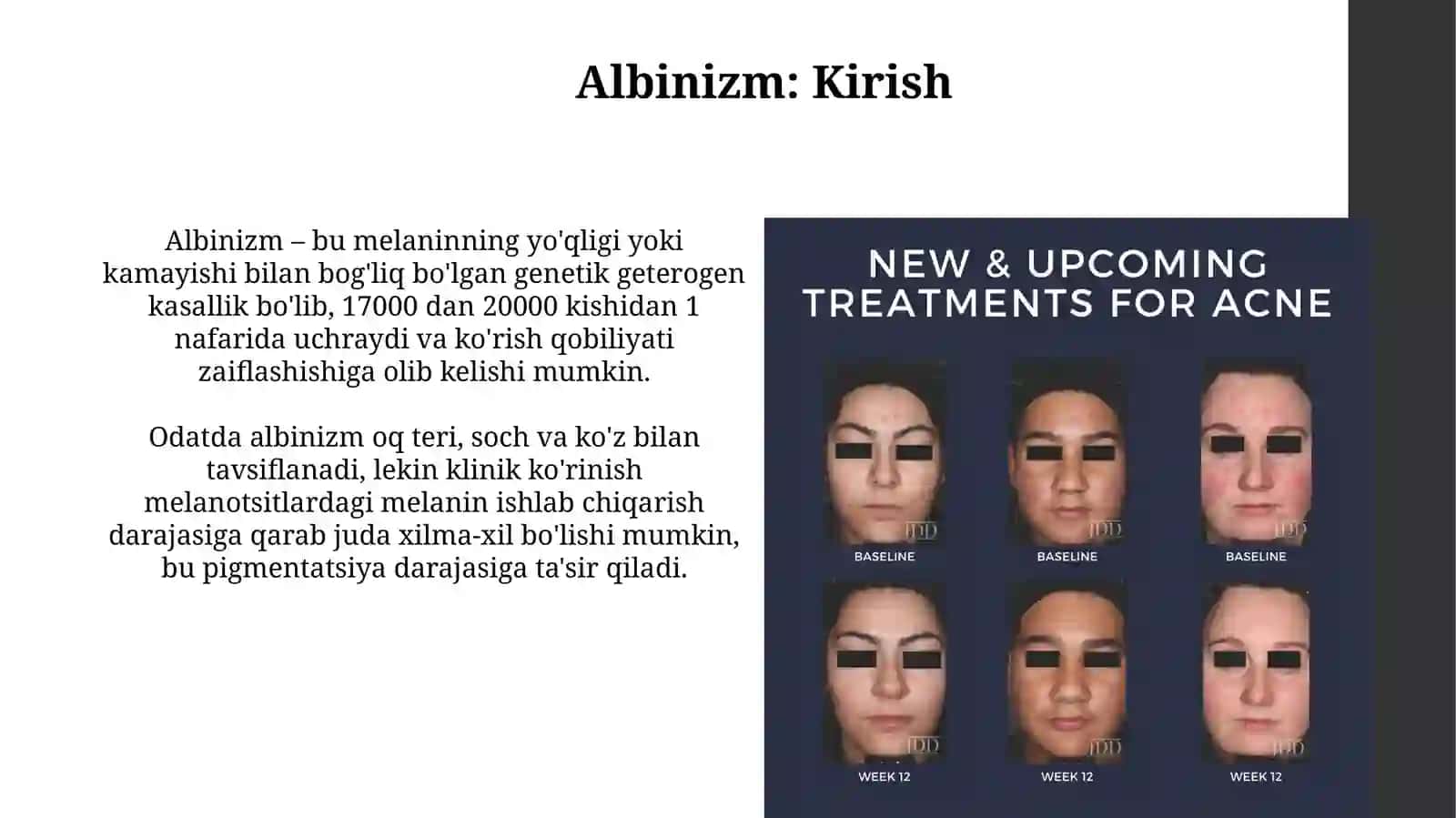 Albinizm etiopotogenezi, klinikasi, diagnostikasi, davolash vaprofilaktikasi 3