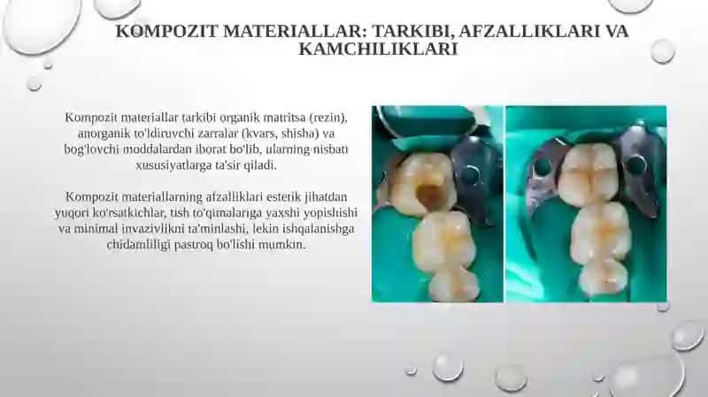 Kompozit materiallar 3