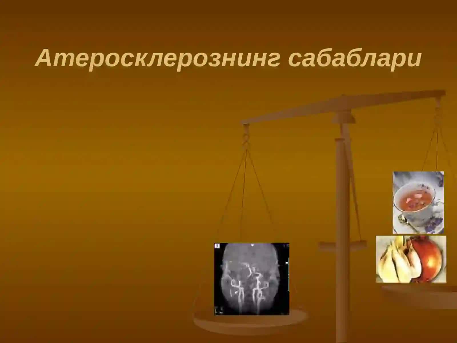 АТЕРОСКЛЕРОЗ 3