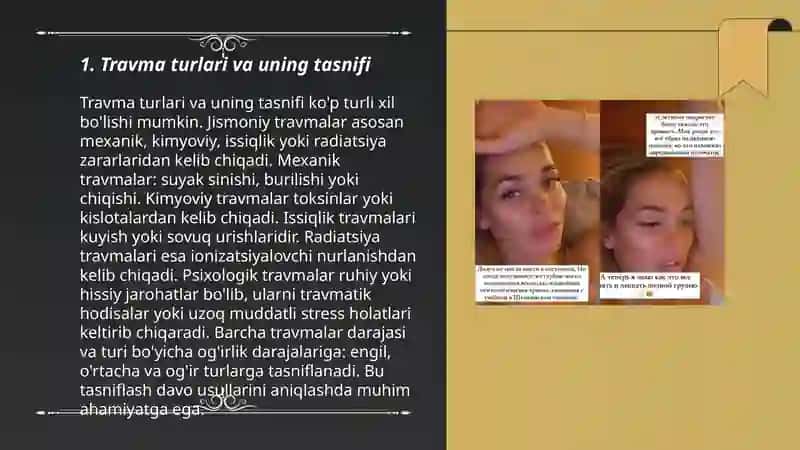 Travma. Umumiy qoidalar. Suyaklarning sinishi va dislokatsiyasi. Yumshoq to'qimalarning yopiq shikastlanishi. Diagnostika va birinchi yordam. 3