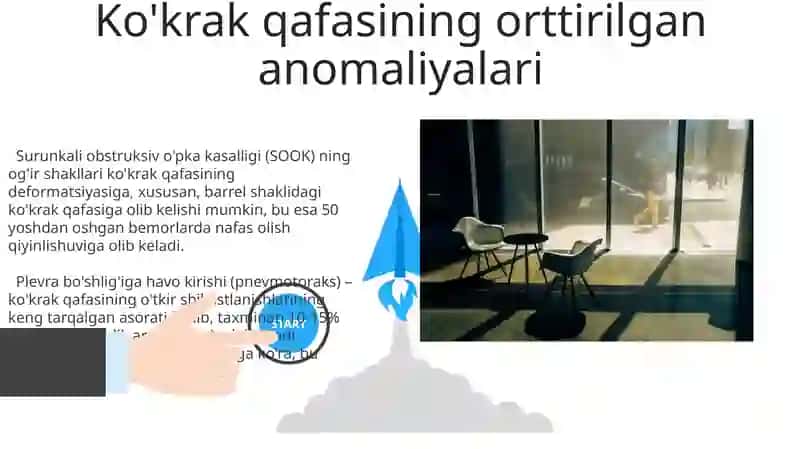 Ko'krak qafasining tugʻma va olingan anamaliyalari 3