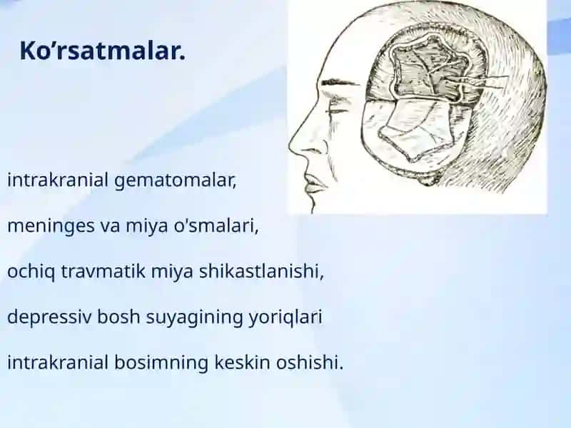 KraniotomiyavaKranioplastika 3