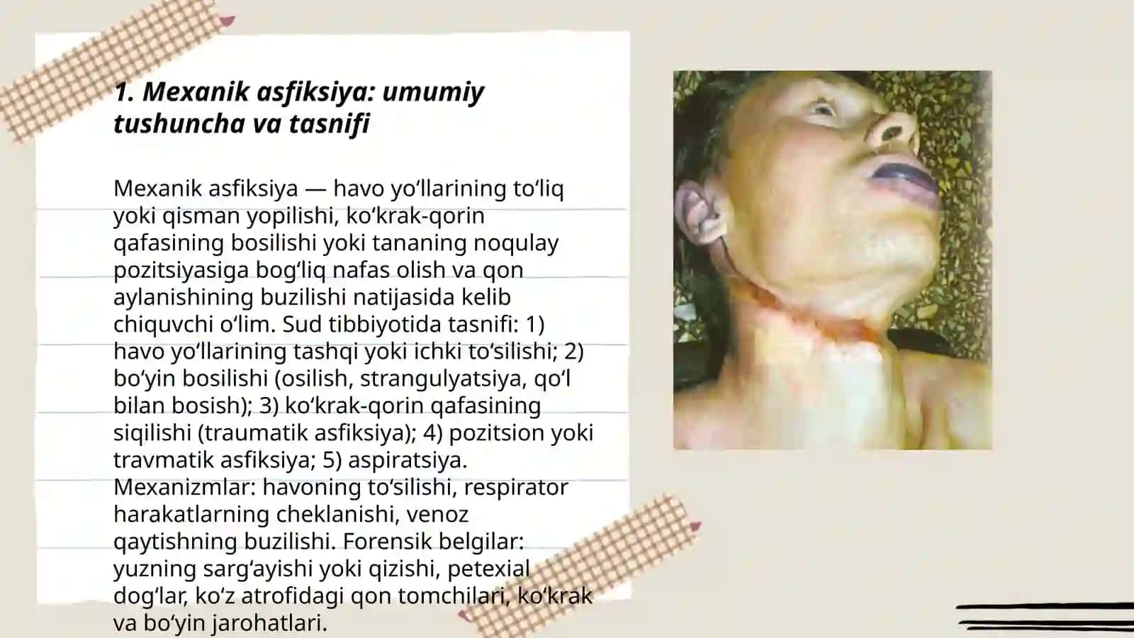 Mexanik asfiksiya: Umumiy tushuncha va tasnifi 3