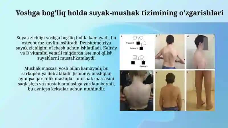 Tayanch xarakat apparatining yoshgd bog'lik xususiyatlari 3