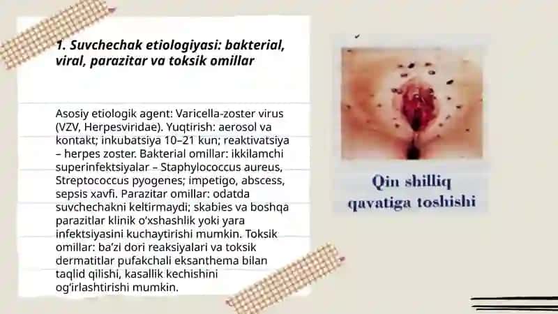 Suvchechak Etiologivasi, epidemiologivasi, patogenezi klinikasi, asoratlari davosi profilaktikasi reabilitatsiyasi UASH taktikasi 3