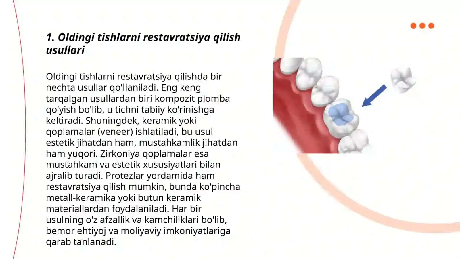 Oldingi tishlarning restavratsiyasi 3