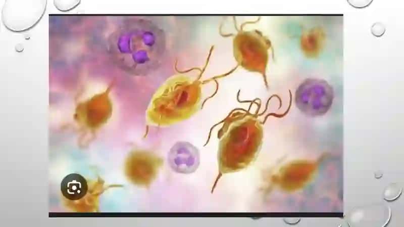 Trixomoniaz etio-patogenezi, klinikasi diagnostikasi va davolashi 3