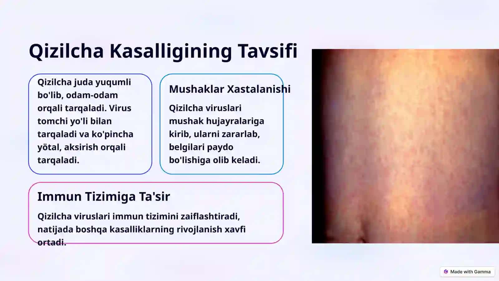 EPIDEMIOLOGIYA fanidan tayyorlaganTAQDIMOTI 3