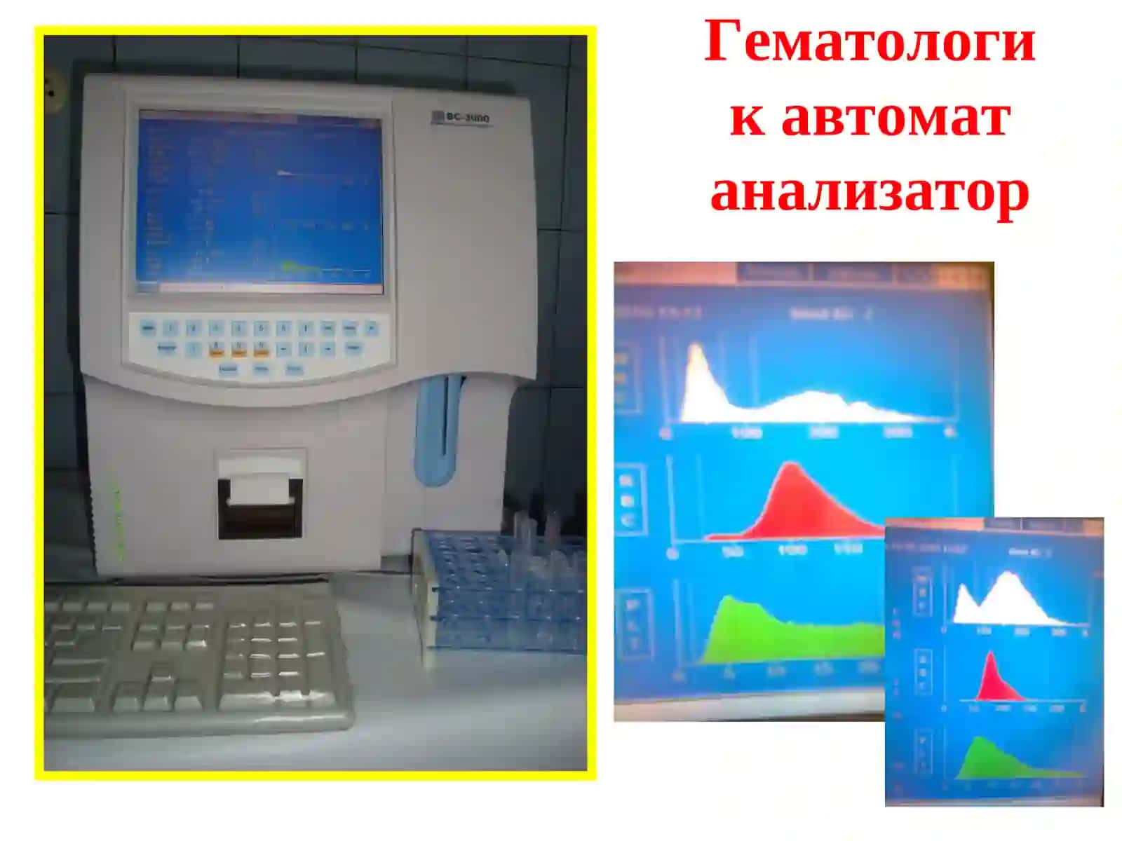 Кон клиник таҳлили ва унинг диагностик аҳамияти 3