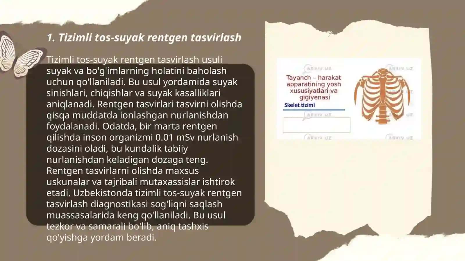 Tayanch harakat tizimi kasalliklari nur tashhisi 3