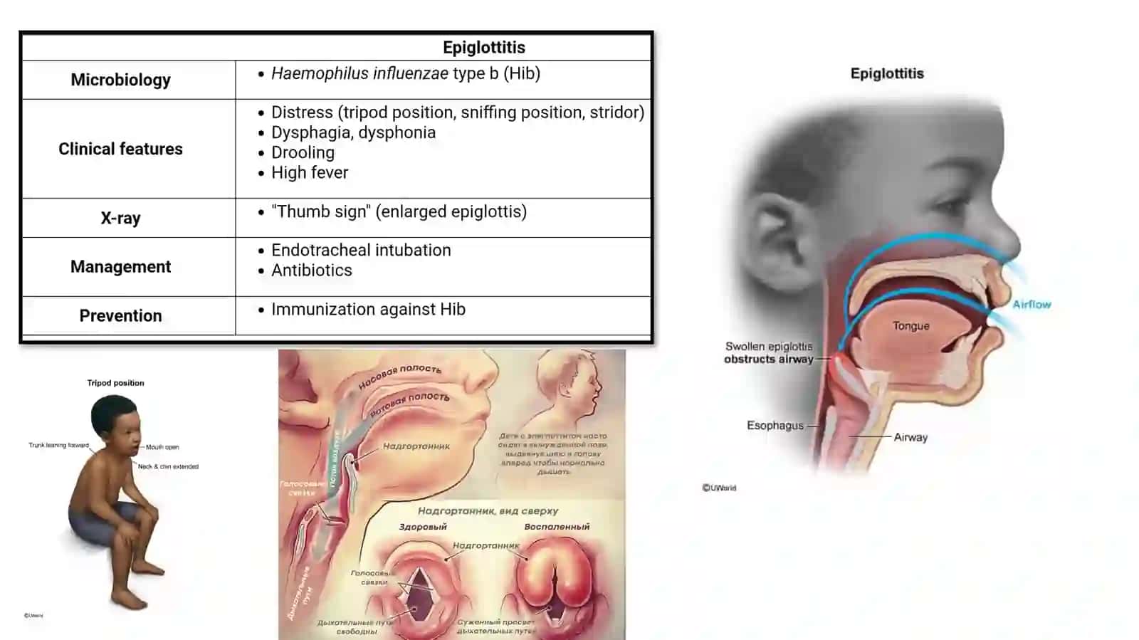 PATOLOGIYA Nafassistemasi patologiyasi 3