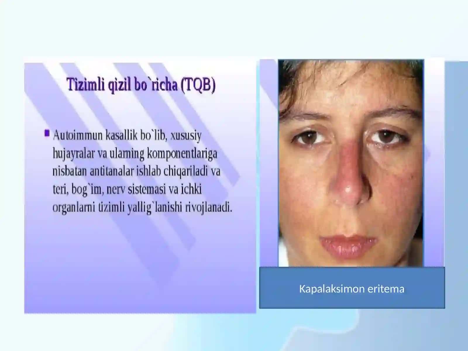 Biriktiruvchi to'qimada diffuz kasalliklarining zamonaviy tekshirish usullari 3