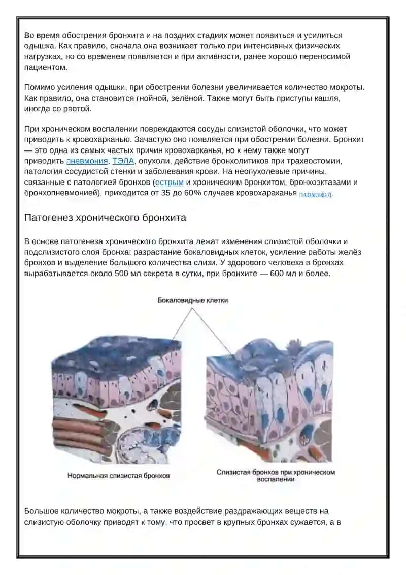 Хронический бронхит 3