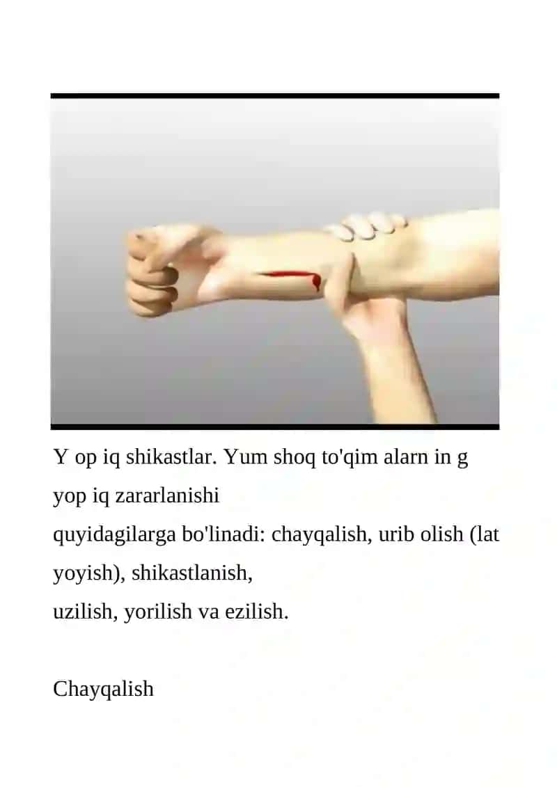 Yumshoq to'qimalarni yopish shikasti chayqalish lat yeyish yirtilish va uzilish ezilish 3