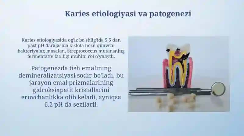 Kariyes bosqichlari. Boshlang‘ich kariyes (dog‘ bosqichidagi kariyes). Yuza kariyesi 3