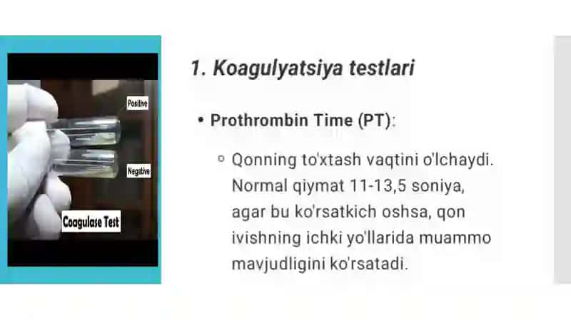 Birlamchi qon ivish tizimi patologiyasilaboratordiagnostikasi 3