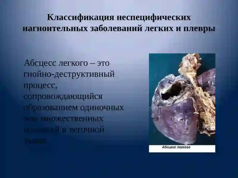 Гнойные заболевания легких и плевры 3
