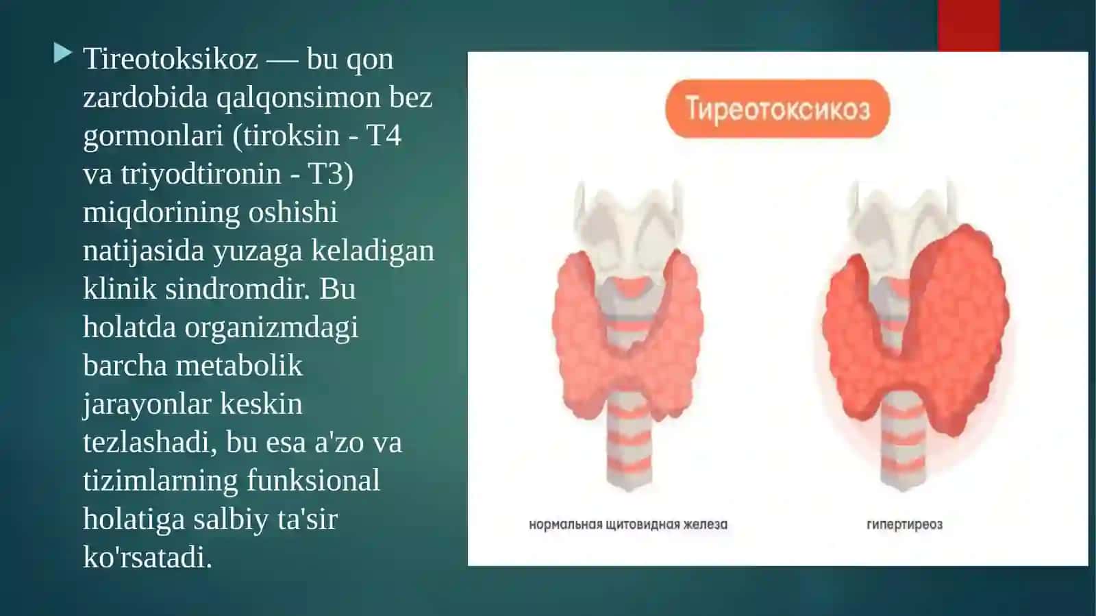 Tireotoksikoz. Etiologiyasi, patogenezi, klinikasi, asoratlari, davolash usullari 3