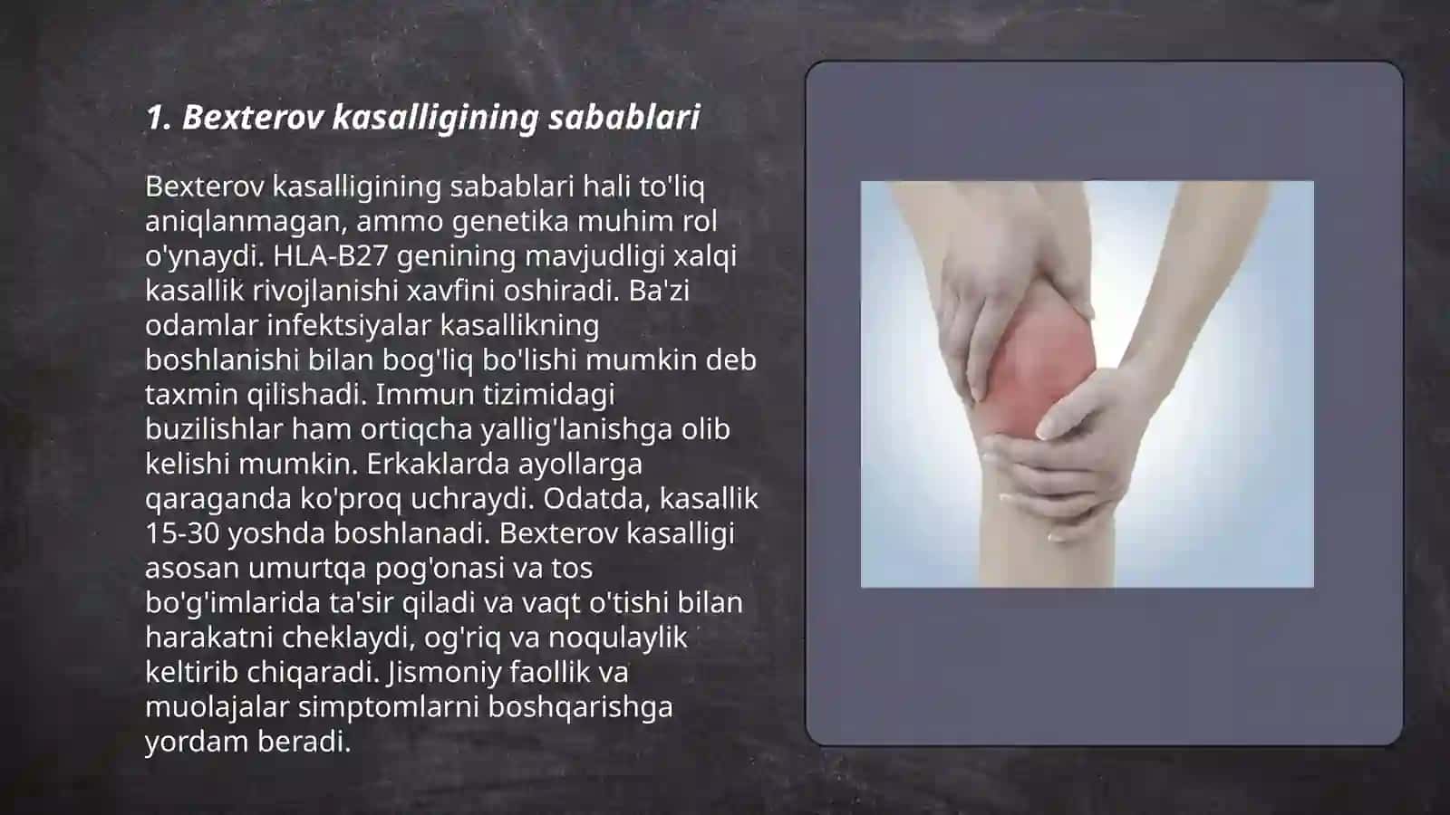 Bexterov kasalligi(autoimmun kasallik ) 3
