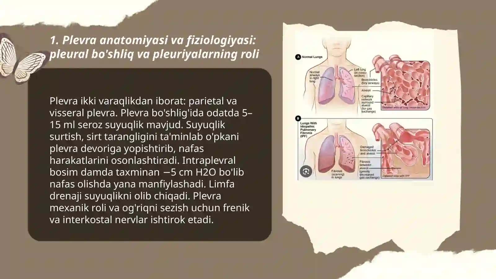 Plevra bo'shlig'ida havo va suyuqlik to'planish sindromi 3