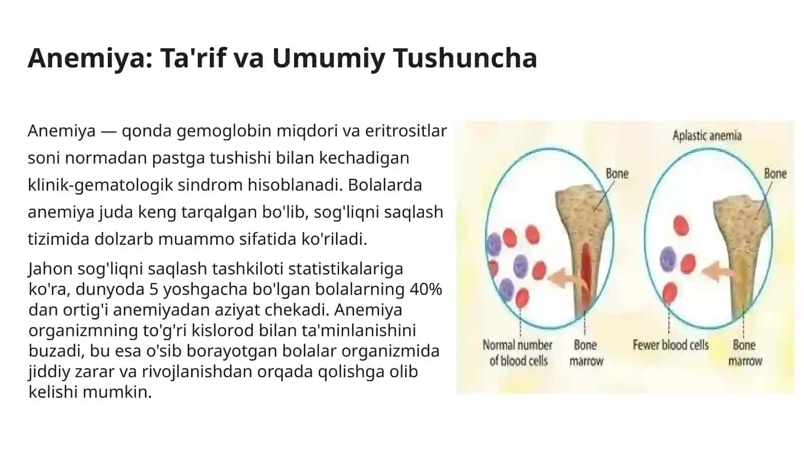 Gipova Aplastik Anemiyalar 3