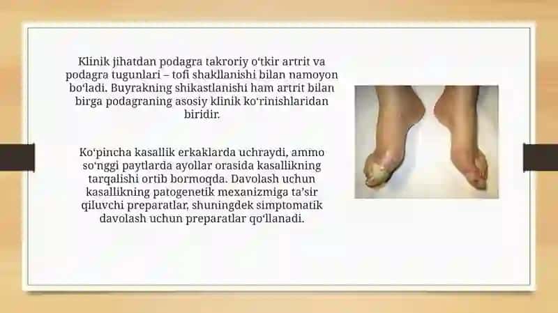 PODAGRA VA SEMIZLIKNI BARTARAF ETUVCHI DORI VOSITALARI 3