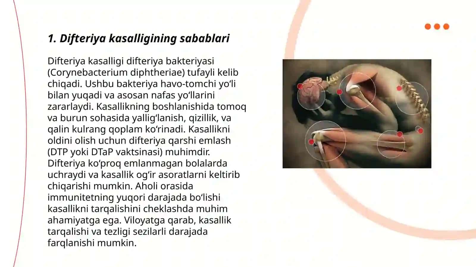 Difteriya kasalligi haqida tushuncha 3
