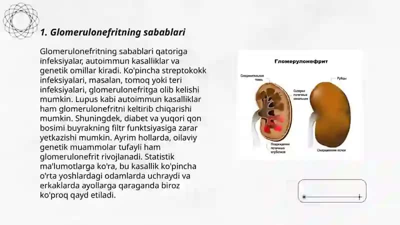 Glomerulonefrit 3
