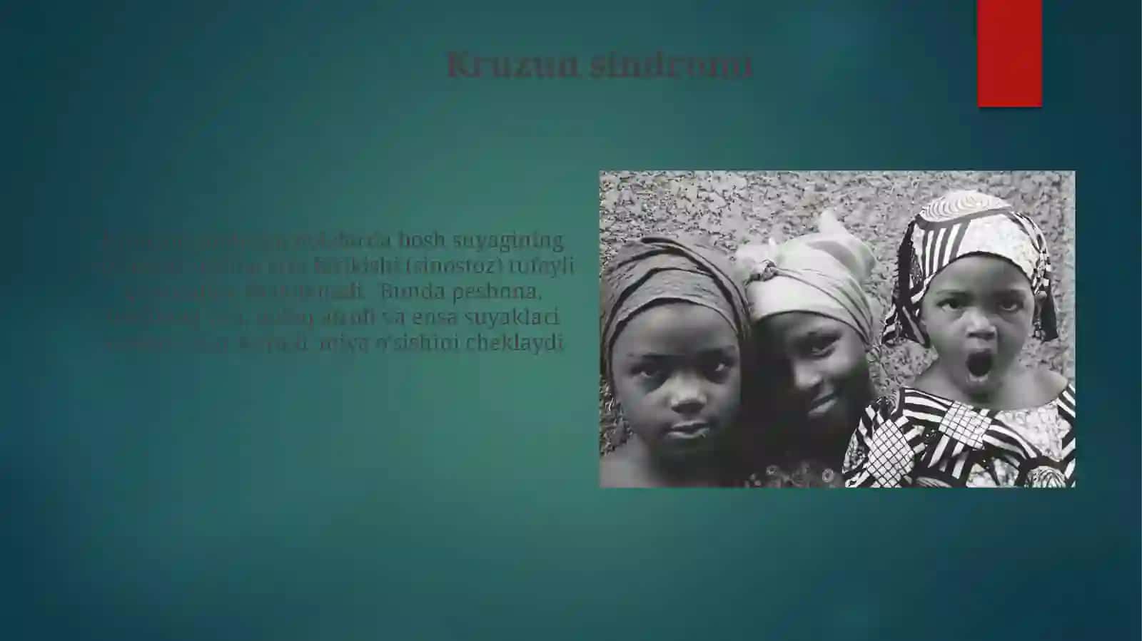 Yosh bolalarkallasuyaklarining xususiyatlari. Rivojlanishdagi anomaliyalari 3