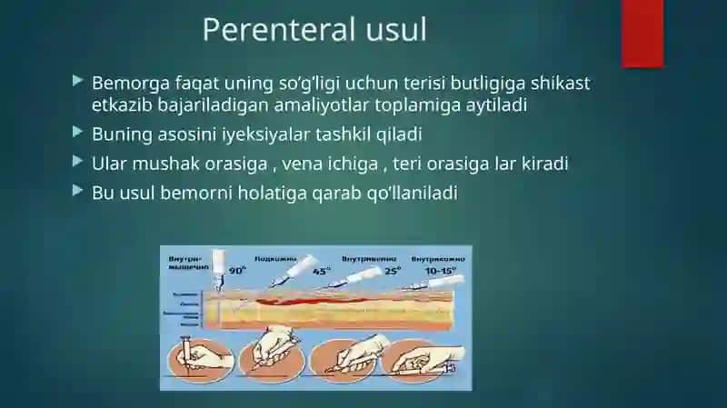 Bolalar xirurgiyasi fanidan taʼyyorlagan taqdimot 3