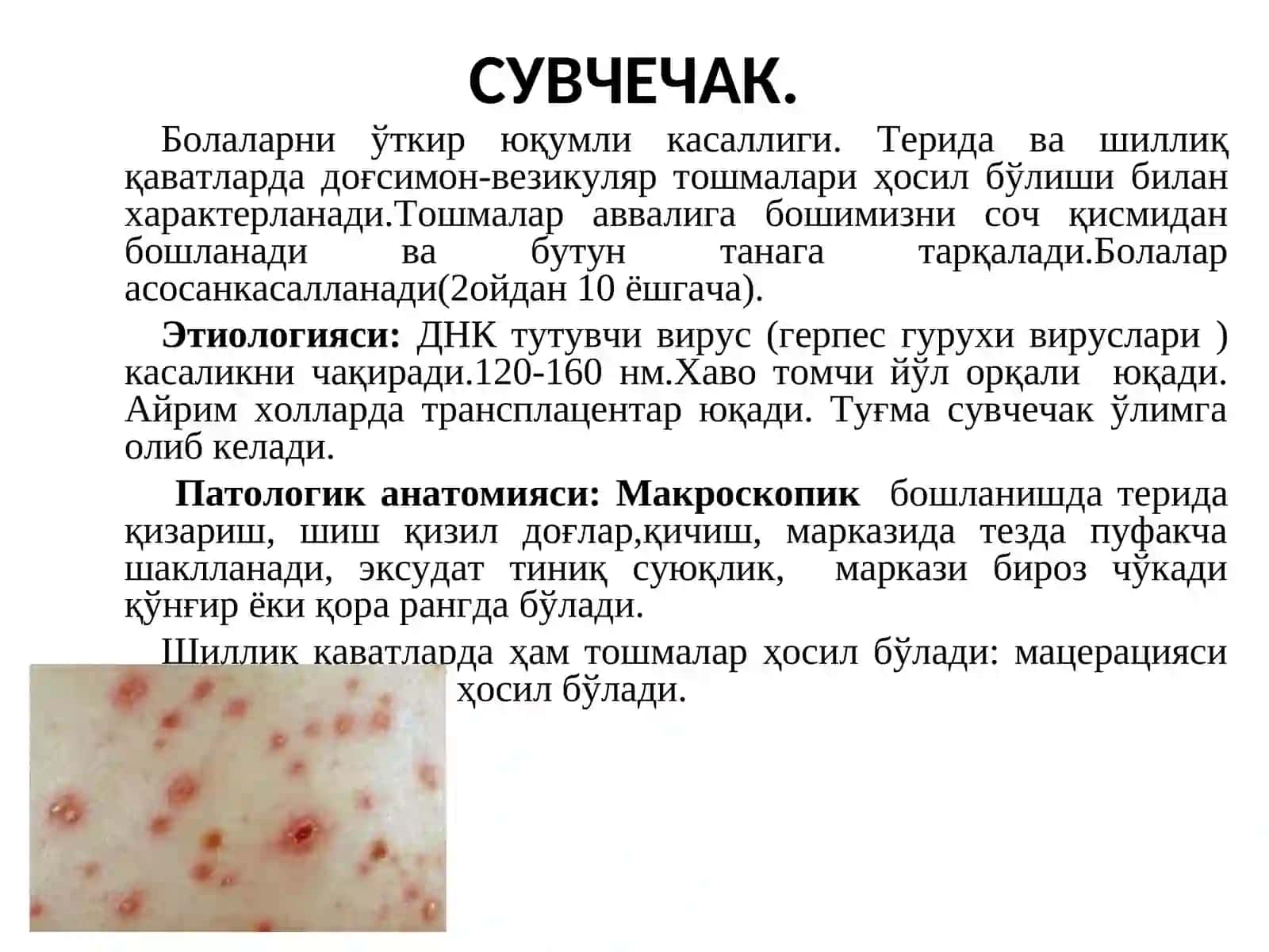 Сувчечак 3