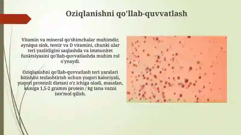 Bullöz epidermoliz, Xeyli-Xeyli kasalligi 3