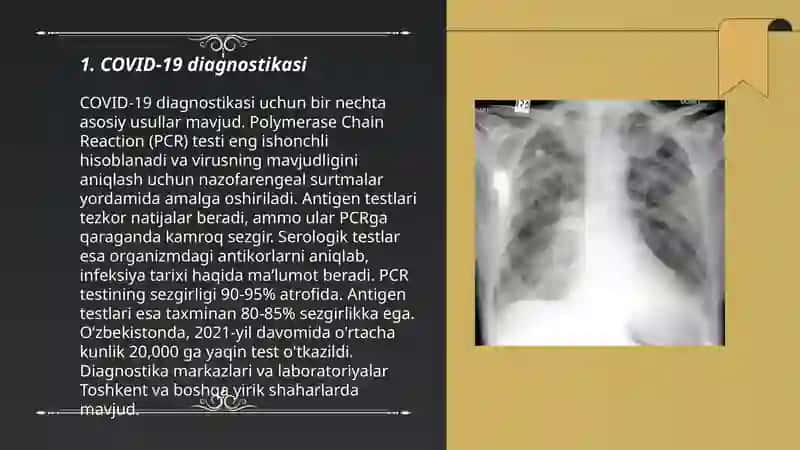 Karonavirus kasalligi nur diagnostikasi 3